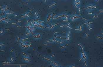 Descrito un nuevo método de edición de la microbiota intestinal