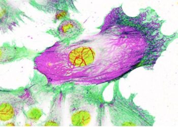 curiosidades-cancer-de-mama-mayo-2019