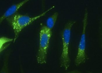 Un estudio con investigadores del CSIC identifica una nueva vía para atacar a las células tumorales