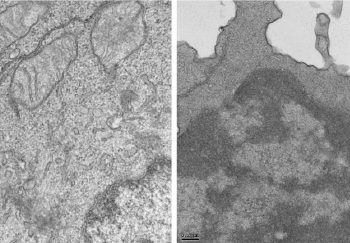 curiosidades-celulas-tumorales-agosto-2019