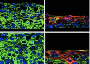 Un estudio identifica moléculas clave para el desarrollo y malignidad de los cánceres de cabeza y cuello