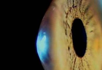 Científicos del CSIC desarrollan nuevas técnicas de imagen para el tratamiento de patologías oculares a la carta