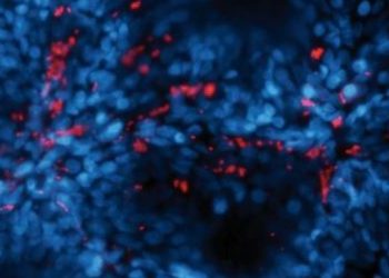 curiosidades-ecoli-bacterias-septiembre-2019