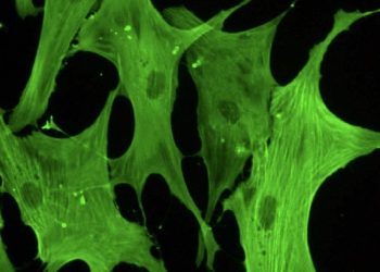 curiosidades-enfermedad-cardiovascular-degenerativa-mayo-2019