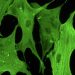 curiosidades-enfermedad-cardiovascular-degenerativa-mayo-2019