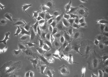 Investigadores del CSIC prueban fármacos usados contra el cáncer para frenar la infección por coronavirus