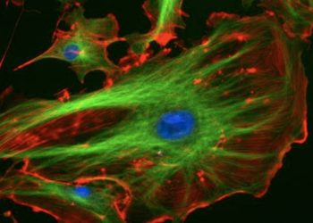 La relación entre el metabolismo y las propiedades mecánicas de las células influye en la metástasis tumoral