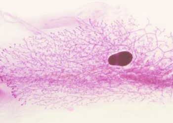 curiosidades-la-disfuncion-de-un-gen-implicado-en-el-sesarrollo-mamario-en-la-pubertad-junio-2019