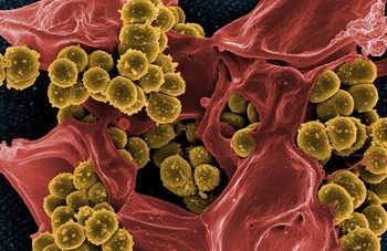 Un estudio muestra que el microbioma intestinal protege frente a la predisposición genética a la leucemia