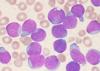 Hallado un mecanismo que inhibe un tipo de leucemia en ratones