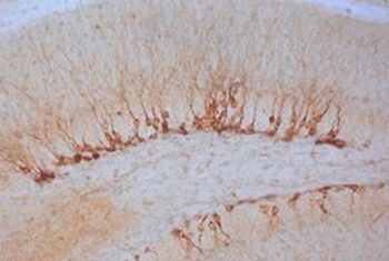 Un estudio del CSIC logra rejuvenecer regiones cerebrales en ratones mediante reprogramación celular