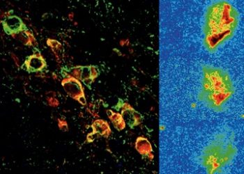 Diseño y ensayo pre-clínico de una nueva molécula para retrasar la progresión del párkinson