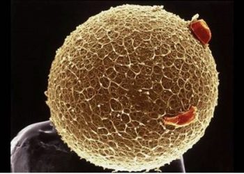 Identifican la causa genética de un tipo de infertilidad femenina