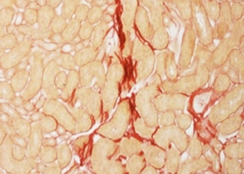 La potencia energética de las células tubulares es clave para combatir la fibrosis renal