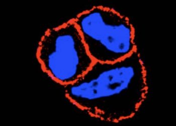 curiosidades-tumores-de-mama-mayo-2020