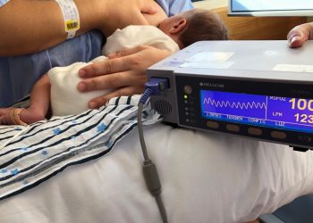 hospital-vega-baja-pulsioximetria-neonatal-octubre-2019