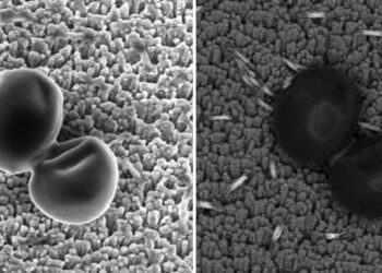imagenes-microscopicas-de-barrido-de-dos-staphylococcus-aureus-csis-enero-2019