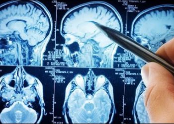 La enfermedad de los mil síntomas