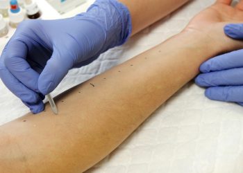 pruebas-cutaneas-alergias-abril-2020