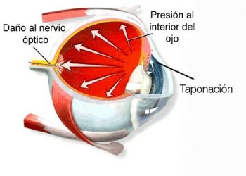 santa-pola-optica-ojo-marzo-2020-3292