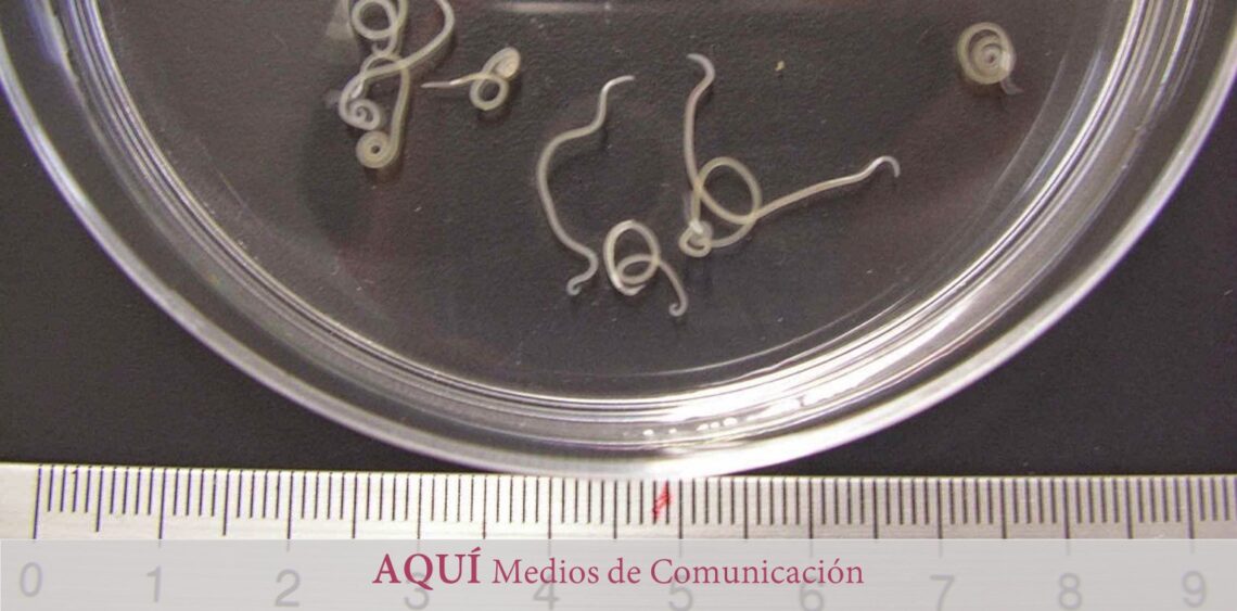 ‘Anisakis’, una ‘bomba’ alergénica