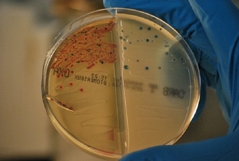 Identificada una nueva estrategia para frenar las resistencias a los antibióticos