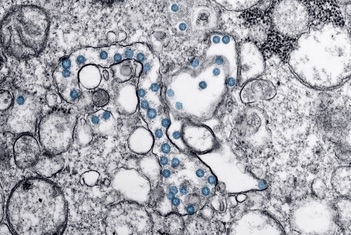 Investigadores del CSIC obtienen un nanomaterial que elimina el coronavirus y es aplicable en mascarillas y tejidos