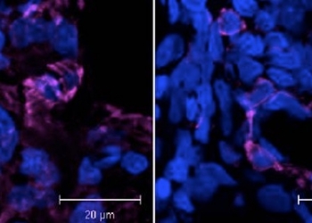 Una nueva terapia utiliza nanopartículas contra la fibrosis pulmonar
