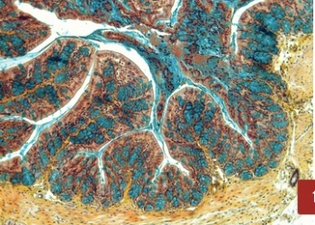 Investigadores del CSIC describen una nueva terapia para el tratamiento de la enfermedad inflamatoria intestinal