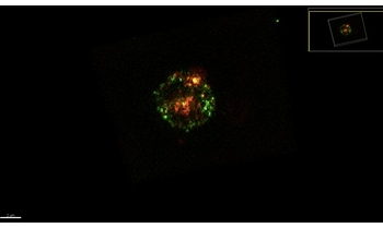 Descubierto por qué un exceso de antígenos en una vacuna puede provocar menor respuesta defensiva
