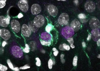 Un mapa genómico celular explica la muerte neuronal en la epilepsia