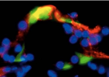 Investigadores del CSIC confirman una nueva estrategia para el tratamiento de la sordera causada por la quimioterapia