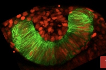 Identifican las instrucciones genéticas clave para la construcción del esbozo ocular