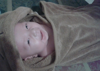 Síndrome de Menkes y sus secuelas