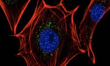 La interacción entre dos proteínas celulares, posible diana frente al cáncer