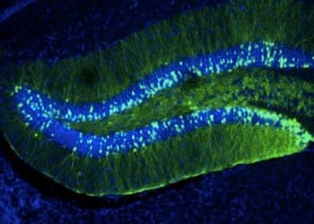 Hallado un gen implicado en la plasticidad del cerebro cuya alteración afecta al aprendizaje y la memoria
