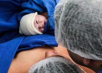 Los microorganismos beneficiosos del parto vaginal pueden restaurarse en nacidos por cesárea