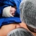 Los microorganismos beneficiosos del parto vaginal pueden restaurarse en nacidos por cesárea