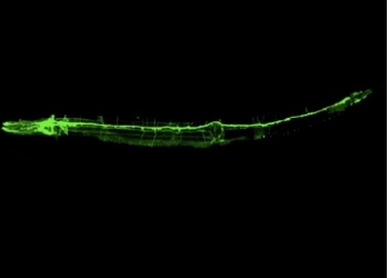 Un estudio del CSIC observa un mecanismo inédito en la formación de las neuronas sensoriales