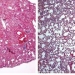 Investigadores del CSIC muestran la eficacia de la molécula cortistatina para tratar la fibrosis pulmonar