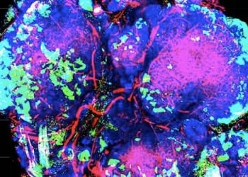 Un equipo del CSIC halla una vía para frenar los tumores impidiendo su adaptación a la falta de oxígeno