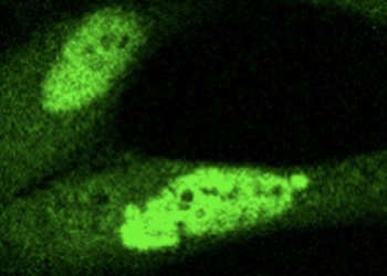 Hallan una alteración clave en los genes implicados en el desarrollo del síndrome de Cornelia de Lange