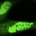 Hallan una alteración clave en los genes implicados en el desarrollo del síndrome de Cornelia de Lange