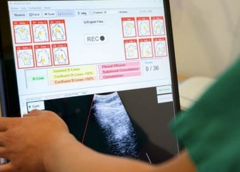 El CSIC desarrolla un ecógrafo pulmonar para el diagnóstico y seguimiento de la covid-19