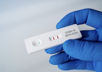 Cómo hacerse el test de antígenos de la farmacia para que sea fiable