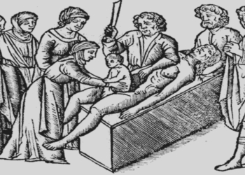 ¿Cuál es la relación entre la cesárea y el emperador Julio César?