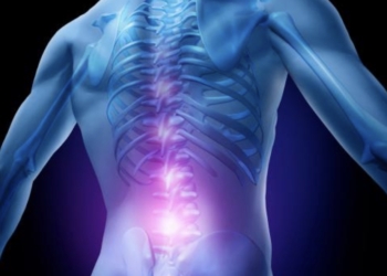 La dolorosa y extendida ciática