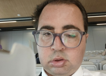 «Me encantaría que mis canciones sirvan para ayudar a la investigación de las enfermedades raras»