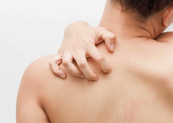 ¿Por qué pica la piel? Causas y soluciones