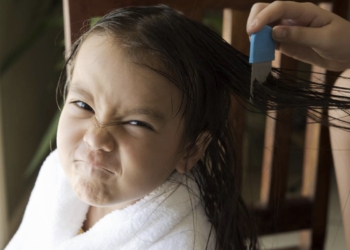 Cómo prevenir y tratar los piojos